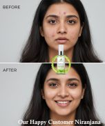 Green Tea Acne Toner - Image 2