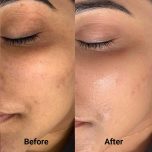 Dry & Sensitive Skin Cleanser - Image 4